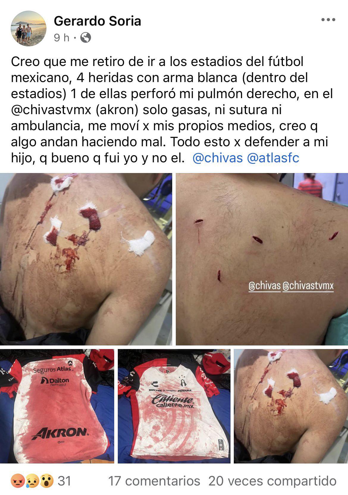 $!FMF abre investigación por agresión en el Clásico Tapatío en el Estadio Akron