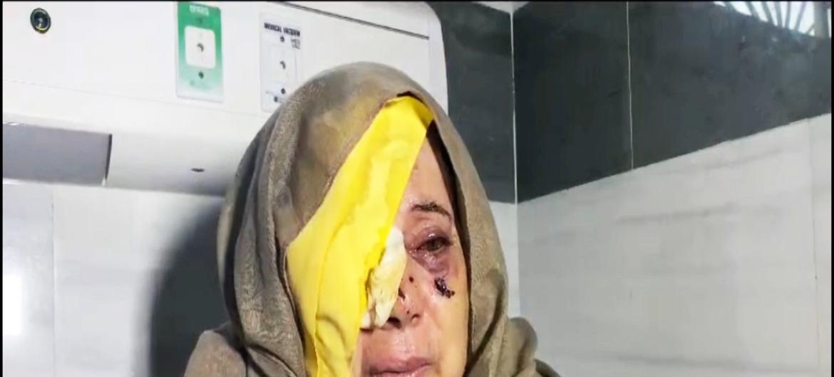 $!Un mujer anciana palestina herida en un ojo tras un ataque del Ejército de israel.