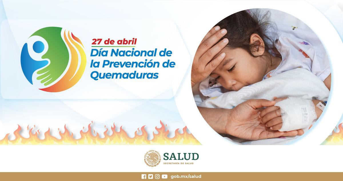 $!Recomienda Salud en Sinaloa medidas para proteger a los niños de las quemaduras