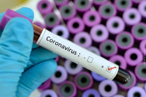 ¿Qué hacer si se sospecha que se tiene el coronavirus?