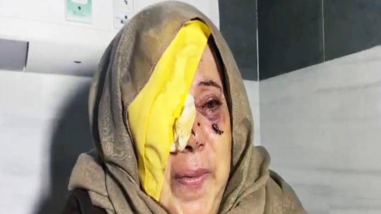 Una mujer anciana palestina herida en un ojo tras un ataque del Ejército de israel.