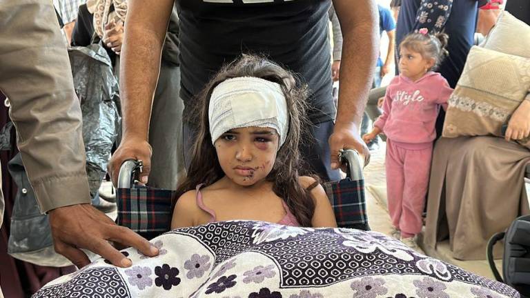 Una misión conjunta de la ONU en el norte de Gaza ayudó a trasladar a algunos pacientes, como esta niña, del Hospital Kamal Adwan al Hospital Al-Shifa.