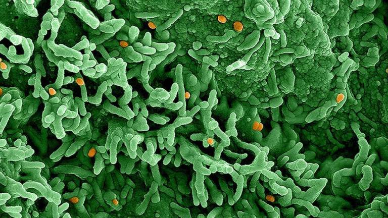 El virus mpox (naranja) infecta las células representadas en verde.